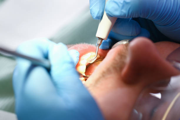 Best Pediatric Emergency Dentist in Gilbert, AZ